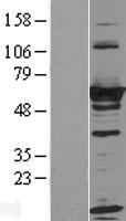 RTKN / Rhotekin Protein - Western validation with an anti-DDK antibody * L: Control HEK293 lysate R: Over-expression lysate