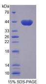 RTKN / Rhotekin Protein - Recombinant Rhotekin (RTKN) by SDS-PAGE