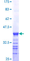 RTKN / Rhotekin Protein - 12.5% SDS-PAGE Stained with Coomassie Blue