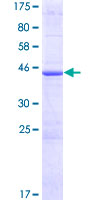 RTKN2 Protein - 12.5% SDS-PAGE of human RTKN2 stained with Coomassie Blue