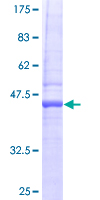 RTKN2 Protein - 12.5% SDS-PAGE of human PLEKHK1 stained with Coomassie Blue