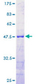 RTN1 / Reticulon 1 Protein - 12.5% SDS-PAGE of human RTN1 stained with Coomassie Blue