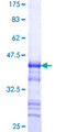 RTN2 / Reticulon 2 Protein - 12.5% SDS-PAGE Stained with Coomassie Blue.