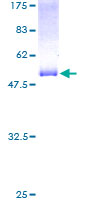 RTN3 / Reticulon 3 Protein - 12.5% SDS-PAGE of human RTN3 stained with Coomassie Blue