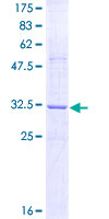 RTN3 / Reticulon 3 Protein - 12.5% SDS-PAGE Stained with Coomassie Blue.