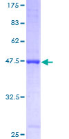RTN4 / Nogo Protein - 12.5% SDS-PAGE of human RTN4 stained with Coomassie Blue