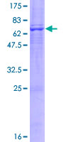 RTN4IP1 / NIMP Protein - 12.5% SDS-PAGE of human RTN4IP1 stained with Coomassie Blue