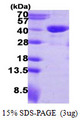 RTN4IP1 / NIMP Protein