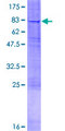 RTN4R Protein - 12.5% SDS-PAGE of human RTN4R stained with Coomassie Blue