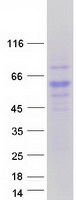 RTN4RL2 Protein - Purified recombinant protein RTN4RL2 was analyzed by SDS-PAGE gel and Coomassie Blue Staining