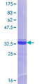 RTP1 Protein - 12.5% SDS-PAGE Stained with Coomassie Blue.