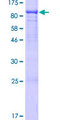 RUNDC1 Protein - 12.5% SDS-PAGE of human RUNDC1 stained with Coomassie Blue