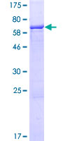 RUNDC3B Protein - 12.5% SDS-PAGE of human RUNDC3B stained with Coomassie Blue