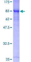 RUNX1T1 / ETO Protein - 12.5% SDS-PAGE of human RUNX1T1 stained with Coomassie Blue