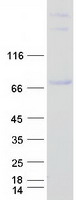 RUNX1T1 / ETO Protein - Purified recombinant protein RUNX1T1 was analyzed by SDS-PAGE gel and Coomassie Blue Staining