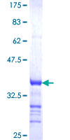 RUNX3 Protein - 12.5% SDS-PAGE Stained with Coomassie Blue.