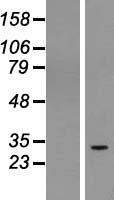 RUSC1-AS1 / C1orf104 Protein - Western validation with an anti-DDK antibody * L: Control HEK293 lysate R: Over-expression lysate
