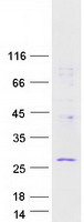 RWDD1 Protein - Purified recombinant protein RWDD1 was analyzed by SDS-PAGE gel and Coomassie Blue Staining