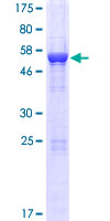 RWDD2A Protein - 12.5% SDS-PAGE of human RWDD2A stained with Coomassie Blue