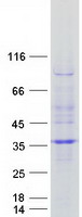 RWDD2A Protein - Purified recombinant protein RWDD2A was analyzed by SDS-PAGE gel and Coomassie Blue Staining