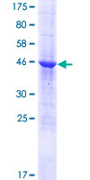 RWDD3 Protein - 12.5% SDS-PAGE of human RWDD3 stained with Coomassie Blue