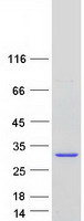 RWDD3 Protein - Purified recombinant protein RWDD3 was analyzed by SDS-PAGE gel and Coomassie Blue Staining