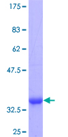 RXFP1/ LGR7 Protein - 12.5% SDS-PAGE Stained with Coomassie Blue.