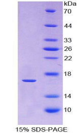 RXFP1/ LGR7 Protein - Recombinant Relaxin/Insulin Like Family Peptide Receptor 1 By SDS-PAGE