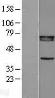 RXRB Protein - Western validation with an anti-DDK antibody * L: Control HEK293 lysate R: Over-expression lysate