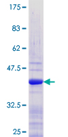RXRB Protein - 12.5% SDS-PAGE Stained with Coomassie Blue.