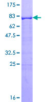 RXRG Protein - 12.5% SDS-PAGE of human RXRG stained with Coomassie Blue
