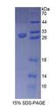 RXRG Protein - Recombinant  Retinoid X Receptor Gamma By SDS-PAGE