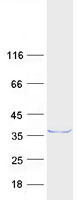 RYBP Protein - Purified recombinant protein RYBP was analyzed by SDS-PAGE gel and Coomassie Blue Staining