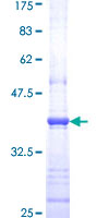 RYK Protein - 12.5% SDS-PAGE Stained with Coomassie Blue.