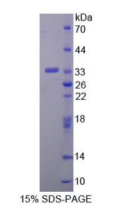 RYK Protein - Recombinant  Related To Receptor Tyrosine Kinase By SDS-PAGE