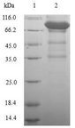 RYR3 / Ryanodine Receptor 3 Protein - (Tris-Glycine gel) Discontinuous SDS-PAGE (reduced) with 5% enrichment gel and 15% separation gel.