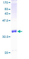 S100A1 / S100-A1 Protein - 12.5% SDS-PAGE of human S100A1 stained with Coomassie Blue