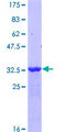 S100A1 / S100-A1 Protein - 12.5% SDS-PAGE Stained with Coomassie Blue.