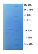 S100A1 / S100-A1 Protein