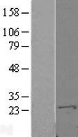 S100A10 Protein - Western validation with an anti-DDK antibody * L: Control HEK293 lysate R: Over-expression lysate