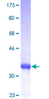 S100A10 Protein - 12.5% SDS-PAGE of human S100A10 stained with Coomassie Blue