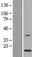 S100A12 Protein - Western validation with an anti-DDK antibody * L: Control HEK293 lysate R: Over-expression lysate
