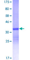 S100A12 Protein - 12.5% SDS-PAGE of human S100A12 stained with Coomassie Blue