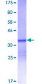 S100A12 Protein - 12.5% SDS-PAGE of human S100A12 stained with Coomassie Blue
