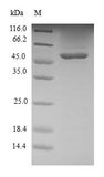 S100A12 Protein - (Tris-Glycine gel) Discontinuous SDS-PAGE (reduced) with 5% enrichment gel and 15% separation gel.