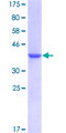 S100A13 Protein - 12.5% SDS-PAGE of human S100A13 stained with Coomassie Blue