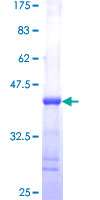 S100A13 Protein - 12.5% SDS-PAGE Stained with Coomassie Blue.