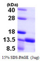S100A16 Protein