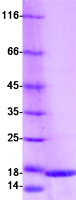 S100A16 Protein - Purified recombinant protein S100A16 was analyzed by SDS-PAGE gel and Coomassie Blue Staining