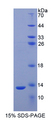 S100A2 Protein - Recombinant S100 Calcium Binding Protein A2 By SDS-PAGE